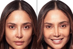 تبييض البشرة في أبو ظبي قبل وبعد