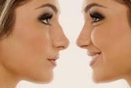 عملية الأنف غير الجراحية 8 عملية الأنف غير الجراحية في أبو ظبي قبل بعد