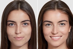 قبل وبعد تبييض البشرة في أبو ظبي