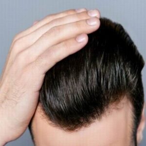 1 Dirham Hair Transplant in Abu Dhabi Al Ain