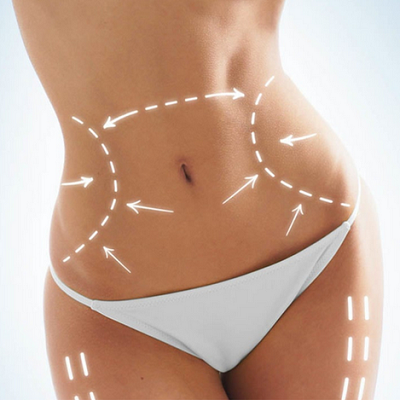 360 Liposuction in Abu Dhabi & Al Ain 7 360-Liposuction-in-Abu-Dhabi-Al-Ain-Liposuction-Abu-Dhabi