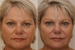 APTOS-Threads-Clinic-in-Abu-Dhabi-Al-Ain