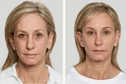 AquaGold-Fine-Touch-in-Abu-Dhabi-Copy