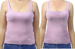 Areola Reduction Clinic UAE