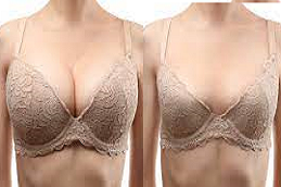 Areola Reduction Clinic in Dubai AbuDhabi