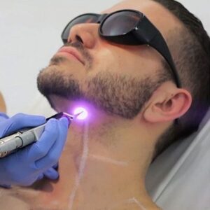 Blog 7 Beard Laser Hair Removal in Abu Dhabi Al Ain Cost Benefits