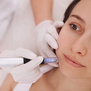 Blog 5 Benefits Side Effects of Mesotherapy in Abu Dhabi