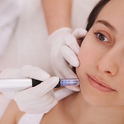 Benefits Side Effects of Mesotherapy in Abu Dhabi