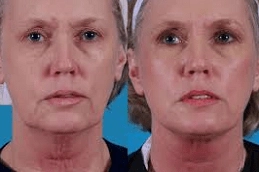 Best-APTOS-Threads-Clinic-in-Abu-Dhabi