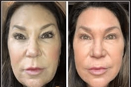 Best AquaGold Fine Touch in Abu Dhabi