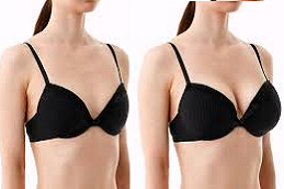 Best Breast Enlargement IInjections Clinic in UAE