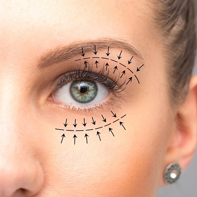 Eyelid Surgery | Blepharoplasty 2 Best Eyelid Surgery in Abu Dhabi khalifa City Cost Price