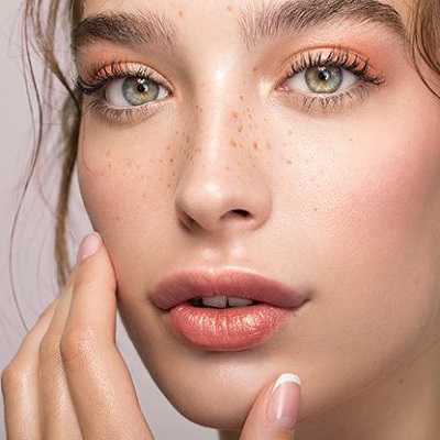 Best Freckles and Blemishes Treatment in Abu Dhabi & Al Ain