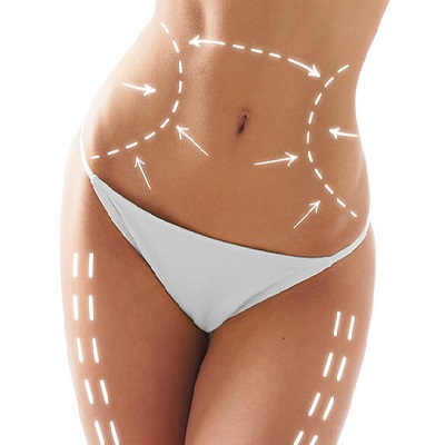Best Laser Liposuction in Abu Dhabi & Al Ain