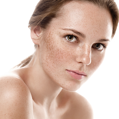 Laser Pigmentation Treatment Cost in Abu Dhabi