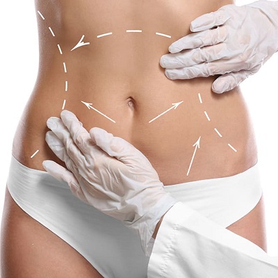Best Liposuction Surgeon in Abu Dhabi Al Ain Best Fat Surgery