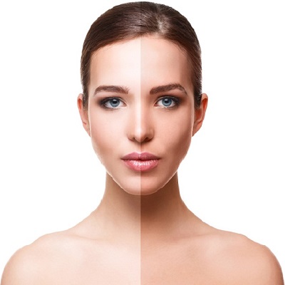 Tan Removal 2 Best Tan Removal Treatment in Abu Dhabi khalifa City & Al Ain