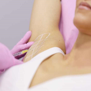 Botox Injections for Sweaty Glands in Abu Dhabi Al Ain