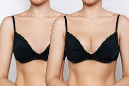 Breast Enlargement Injections 5 Breast Enlargment Injections