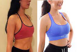 Breast Implants 5 Breast Implants in Abu Dhabi