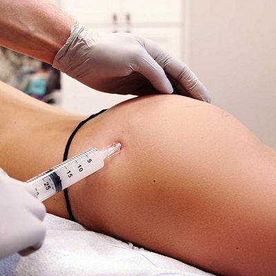 Butt Injections Abu Dhabi Al Ain Butt Filler Cost
