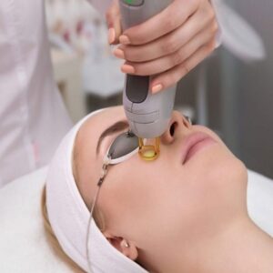 Blog 1 CO2 Laser Treatment cost in Abu Dhabi Al Ain