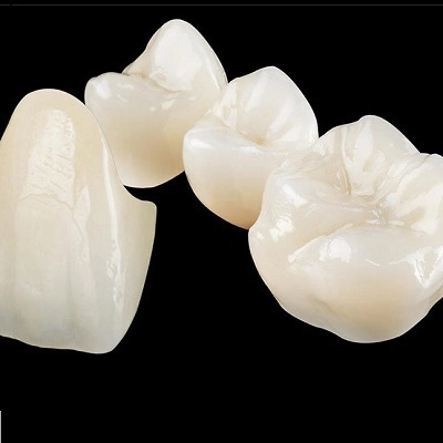 Ceramic Crowns in Abu Dhabi & Al Ain Ceramic Crowns Cost