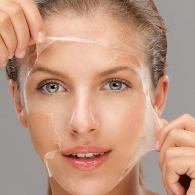 Chemical Peel For Hyperpigmentation 2 Chemical Peel For Hyperpigmentation in Abu Dhabi Price Cost