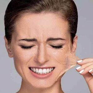 Chemical Peel at Home Why it is Dangerous Royal Clinic Abu Dhabi