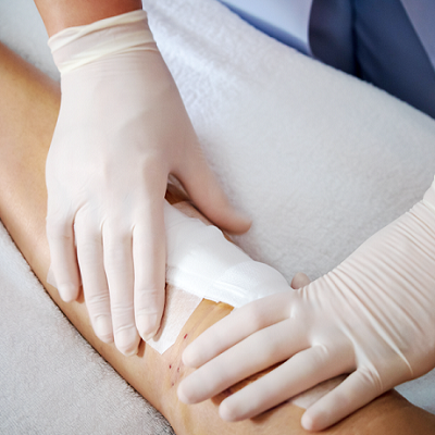 Chronic Wounds Treatment 2 Chronic wounds in Abu Dhabi & Al Ain Chronic Wound TreatmenT