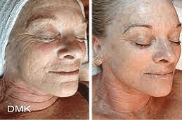 DMK-Enzymatic-Treatment-in-Abu-Dhabi-Al-Ain