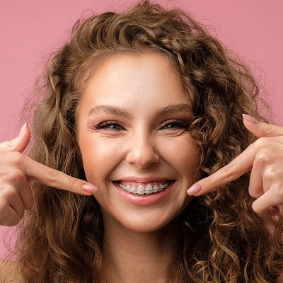 Dental Braces 2 Dental Braces in Abu Dhabi Al Ain Teeth Straightening Cost