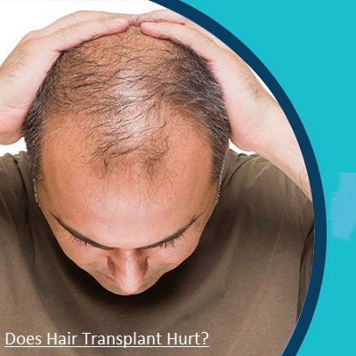 Does Hair Transplant Surgery Hurt? 2 Does Hair Transplant Surgery Hurt Hair Transplant AbU Dhabi