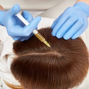 Blog 2 Does PRP Work for Hair Loss PRP in Abu Dhabi Al Ain