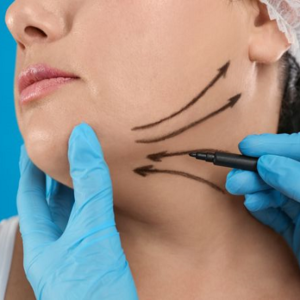 Blog 1 Double chin removal in Abu Dhabi