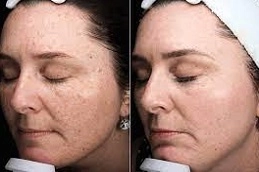 Enlighten-Pico-Genesis-in-Abu-Dhab-Al-Ain