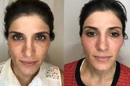 Enlighten-Pico-Genesis-in-Abu-Dhabi