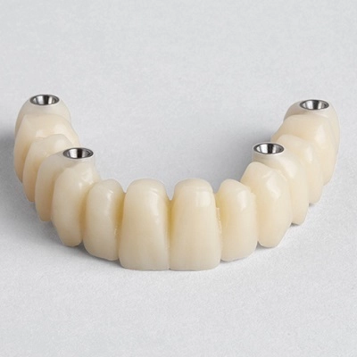 Esthetic Bridge in Abu Dhabi & Al Ain Bridge Cost UAE