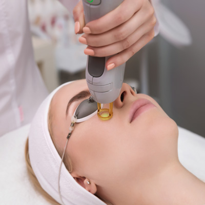 Face Laser Hair Removal in Abu Dhabi 9 Face laser hair removal in Abu Dhabi Al Ain
