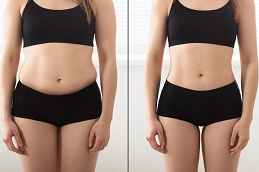 Fat Reduction Clinic in UAE