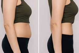 Fat Reduction 5 Fat Reduction in Abu Dhabi