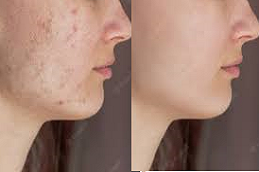 Freckless and Belmishes in Abu Dhabi