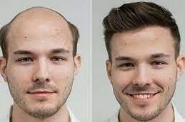 Front line hair fixing in Abu Dhabi