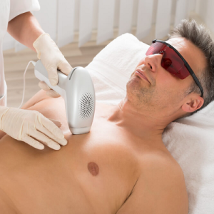 Full Body Laser Hair Removal for Males in Abu Dhabi