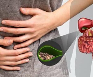 Blog 1 Gallbladder Stone Surgery Cost in Abu Dhabi
