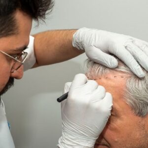 Blog 11 Hair Clinic in Abu Dhabi Al Ain Hair Specialist Doctor