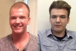 Hair Implants Clinic 4 Hair-Implants-in-Abu-Dhabi-Al-Ain