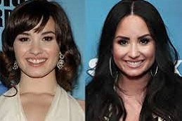 Hollywood-Smile-Makeover-in-Abu-Dhabi