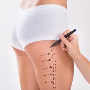 How Much Does it Cost to get your Thighs Done in Abu Dhabi