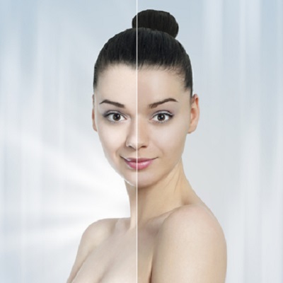 Laser Skin Whitening Treatment Cost in Abu Dhabi Al Ain